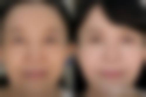 程春玉医生技术优势