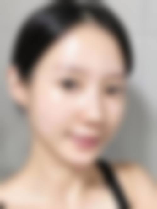 程春玉医生项目收费价格