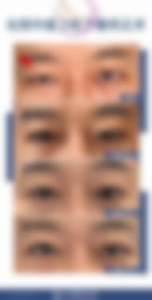 临床实例分享