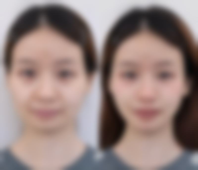 刘敏医生技术优势