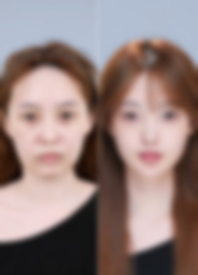 邓小礼医生预约挂号