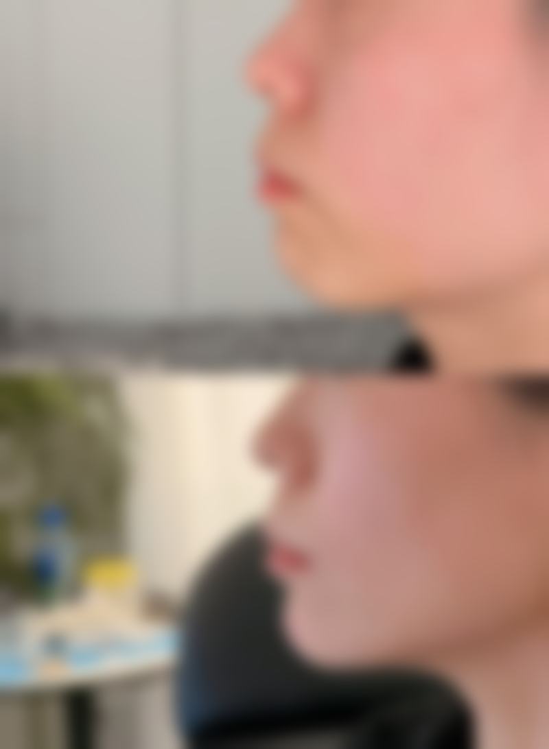 郭爱萍医生项目收费价格