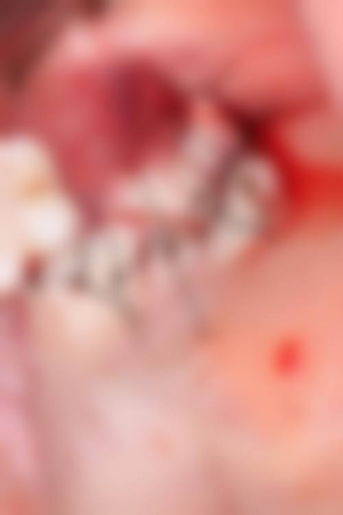 临床实例分享