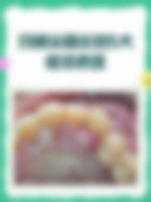 预约优惠活动