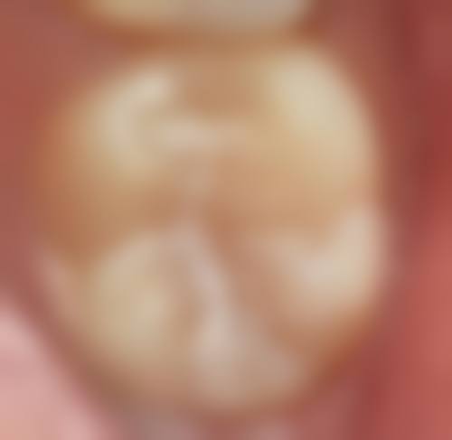 擅长项目详解