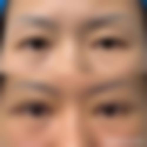 赵倚辰医生项目收费价格