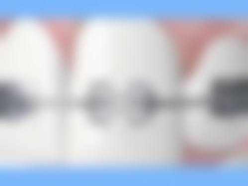 擅长项目详解