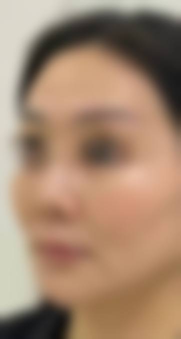 邵刚医生项目收费价格