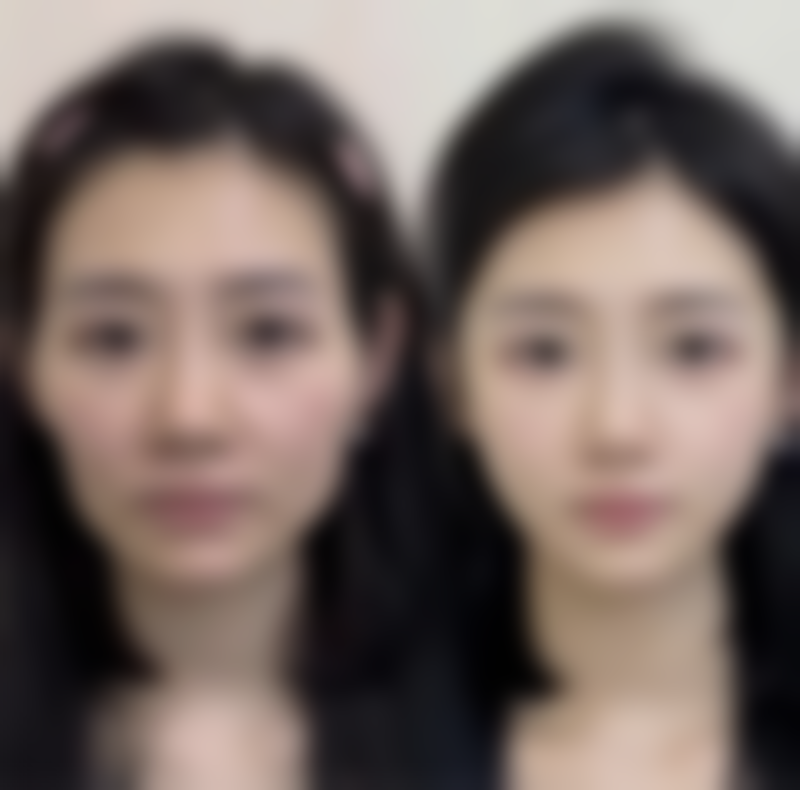 童富江医生项目收费价格