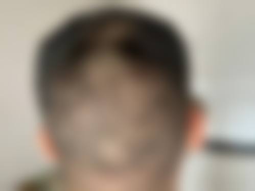 成都新生植发医院医疗环境与配套设施