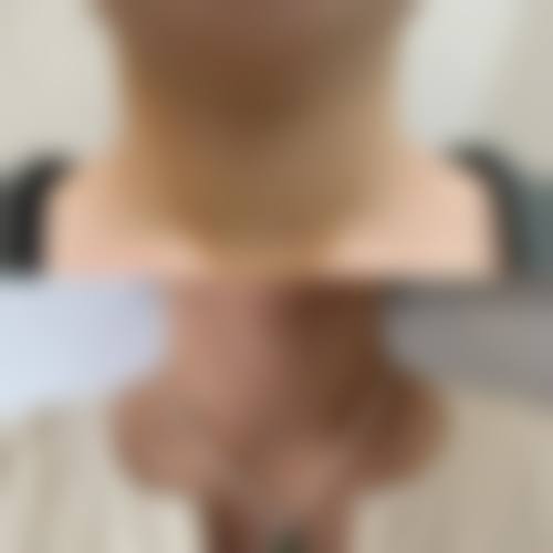 常见问题解答