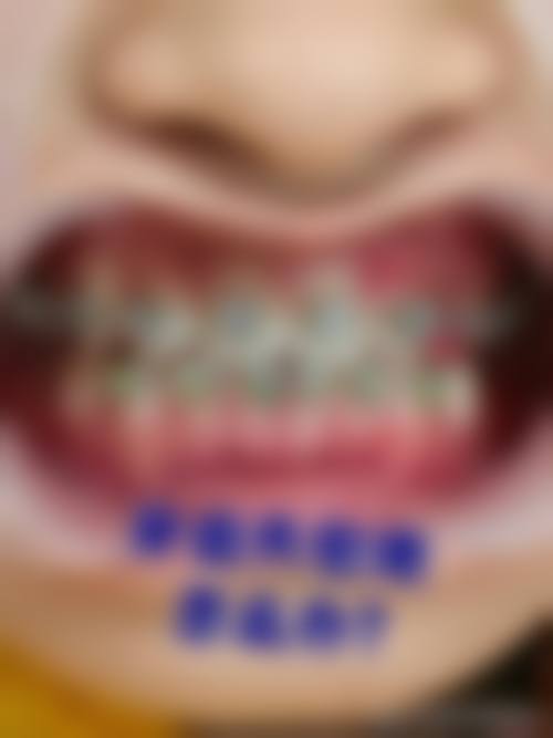 优惠活动详情：透明价格与专属补贴