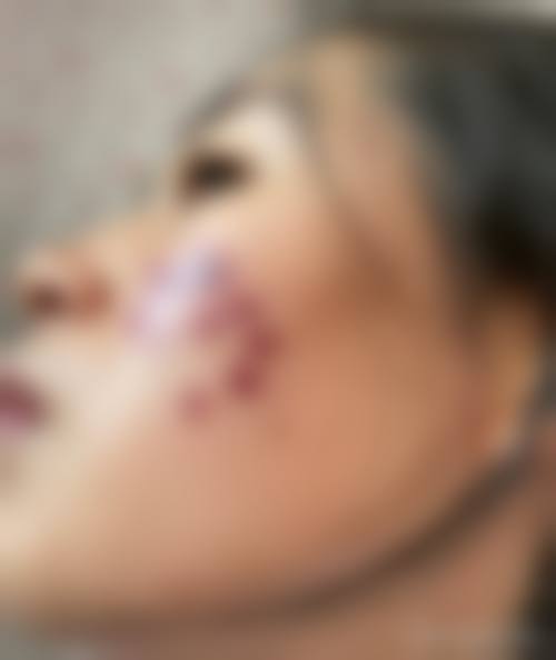 临床实例分享