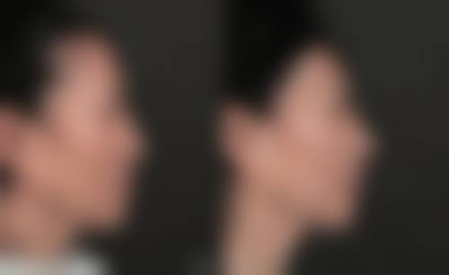 患者真实评价