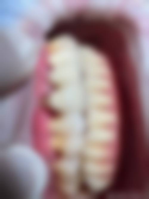 优惠活动详情:限时折扣,性价比更高