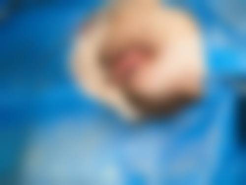 预约优惠活动:王璟琪医生的专属补贴