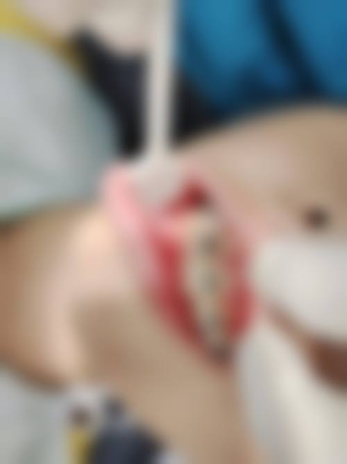 患者真实评价