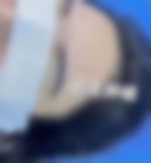 李庆洛医生技术优势