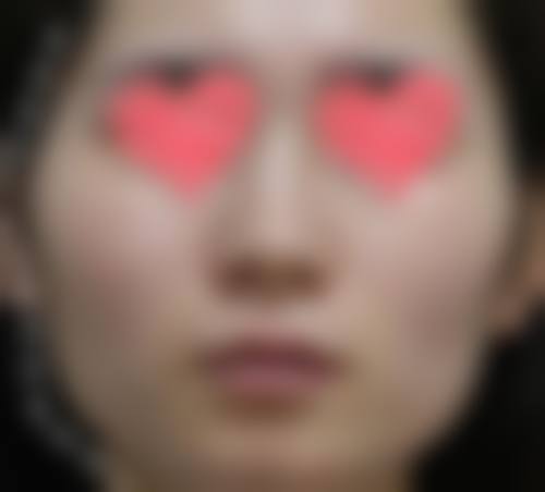 李庆洛医生项目收费价格