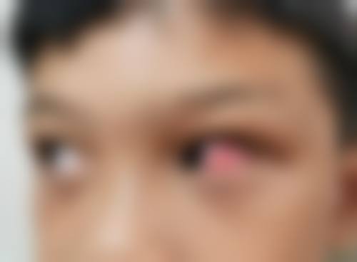 结语:值得信赖的眼科健康守护者