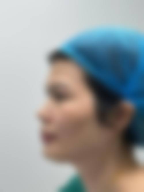 结尾:选择上海针美汇,开启美丽之旅