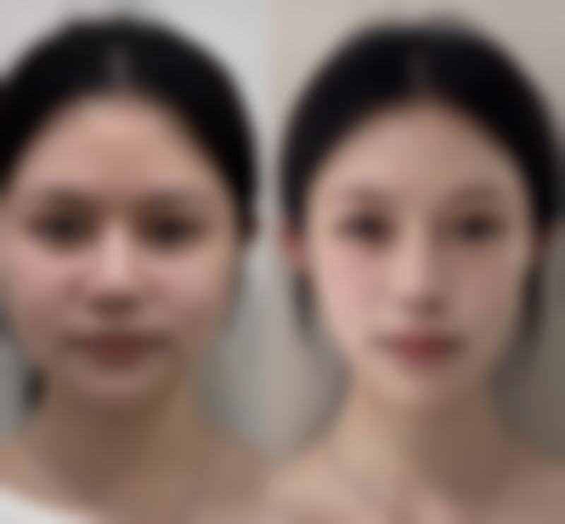 坐诊医院:复旦大学附属中山医院整形美容科实力如何?