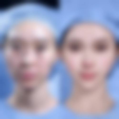 五、临沂赫本医疗美容门诊部的医生团队：专精与用心并重