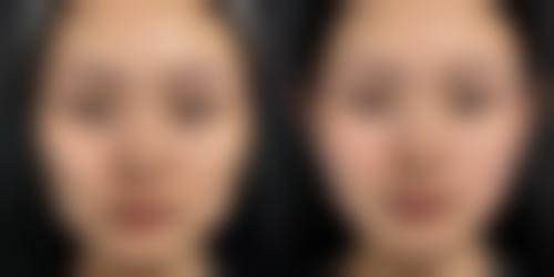 泉州丰泽脂管加医疗美容门诊如何预约?