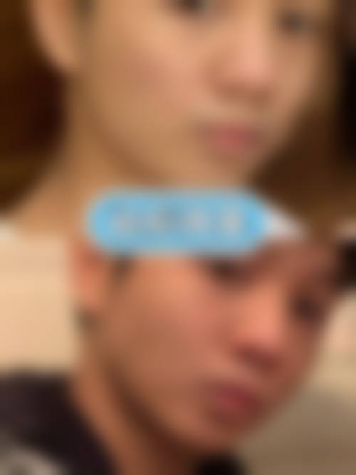 临床实例分享