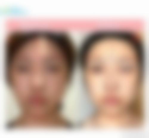 常见问题答疑
