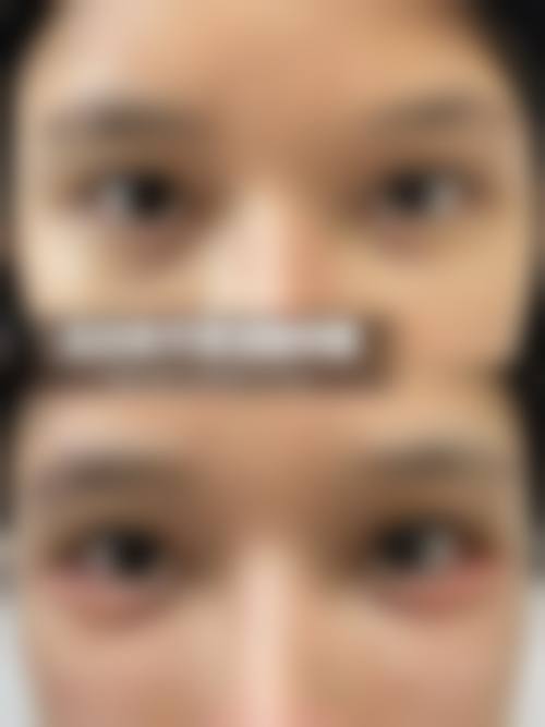 优惠活动详情:限时补贴,助力蜕变