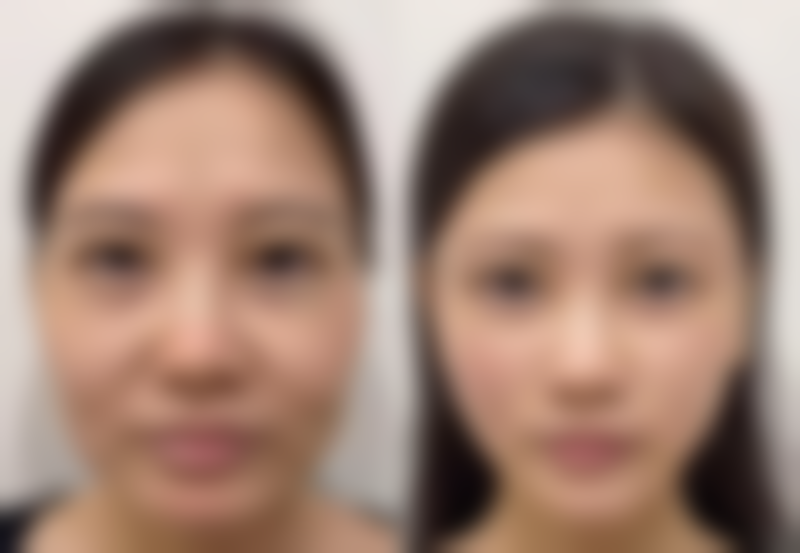 六、求美者眼中的临沂赫本医疗美容门诊部：真实口碑分享